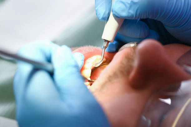 Best Emergency Treatment for Dental Infections or Abscesses in Muldraugh, KY