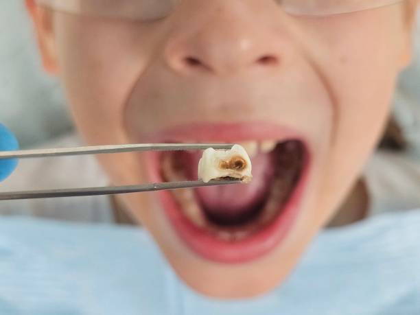 Best Emergency Gum Treatment in Muldraugh, KY